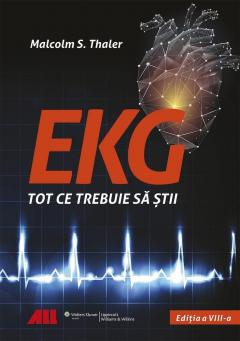 EKG - Tot ce trebuie sa stii